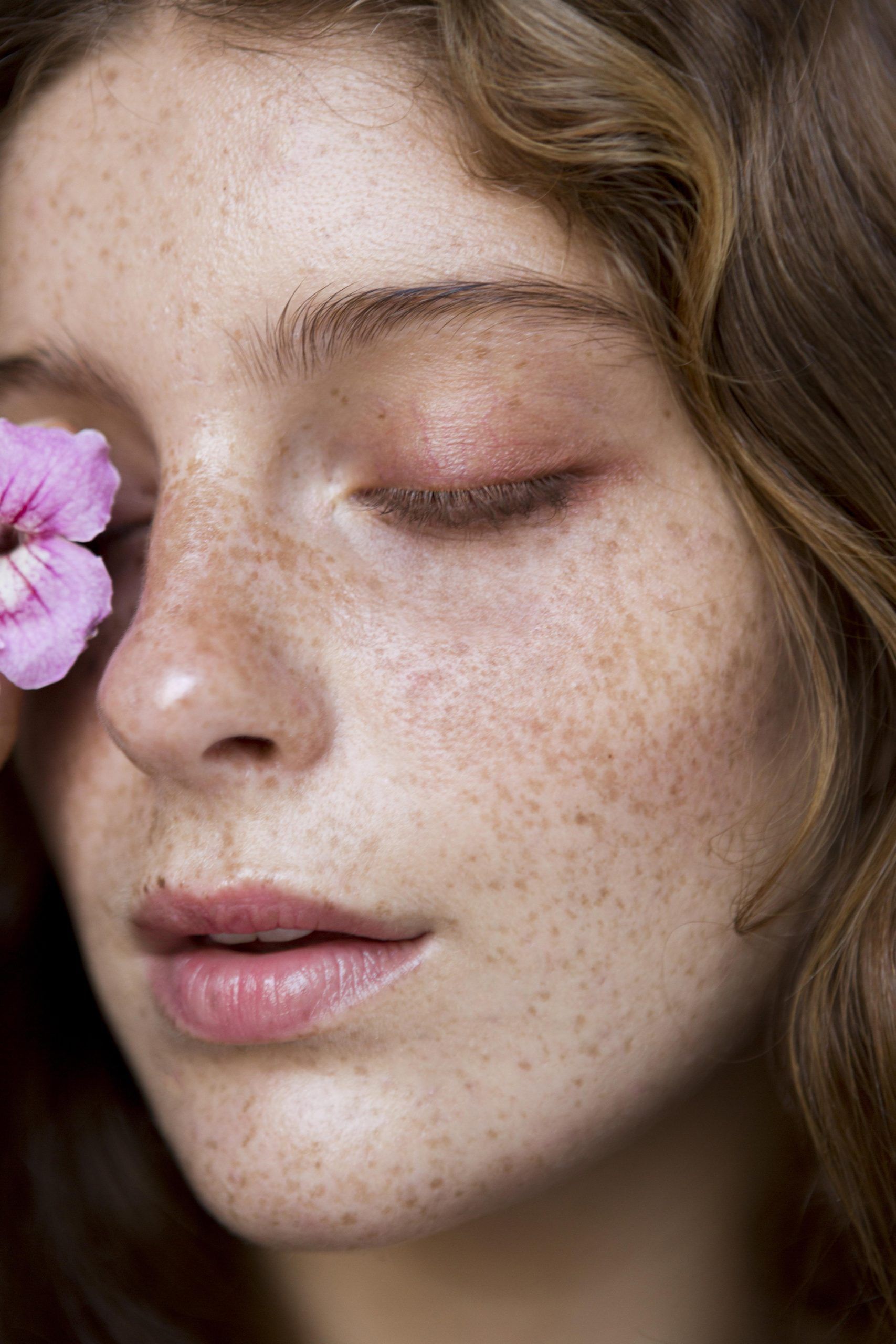 freckled woman covering her eye with flower