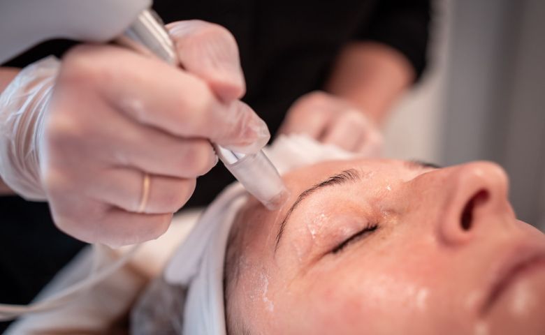 microneedlign